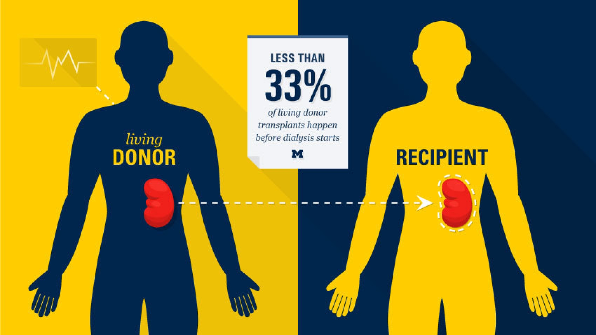 Kidney Transplants Before Dialysis | Michigan Health Lab