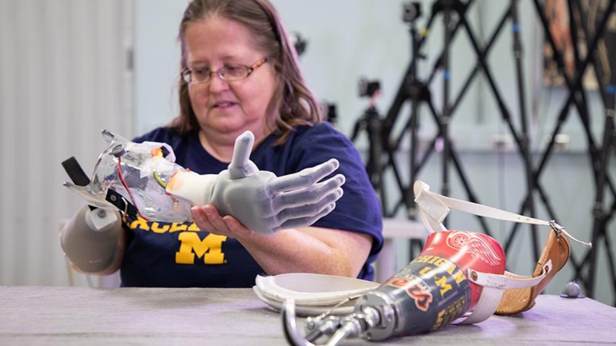 Above-the-elbow amputee 'moves individual fingers in bionic limb in world  first
