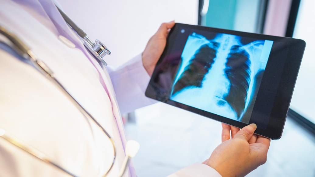 xray on tablet held by clinician in white coat and stethoscope 