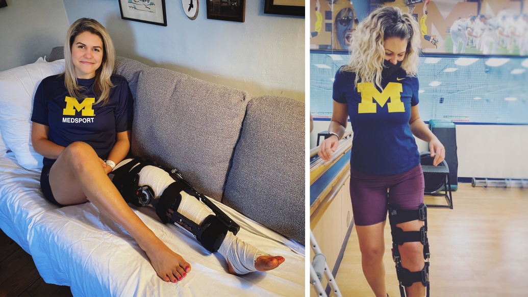 girl sitting on couch with brace on and standing with brace on in UM shirts