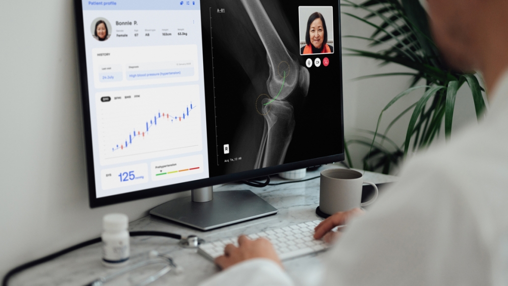 screen of chart and xray and patient and doctor white coat vague in background at computer sitting at keyboard