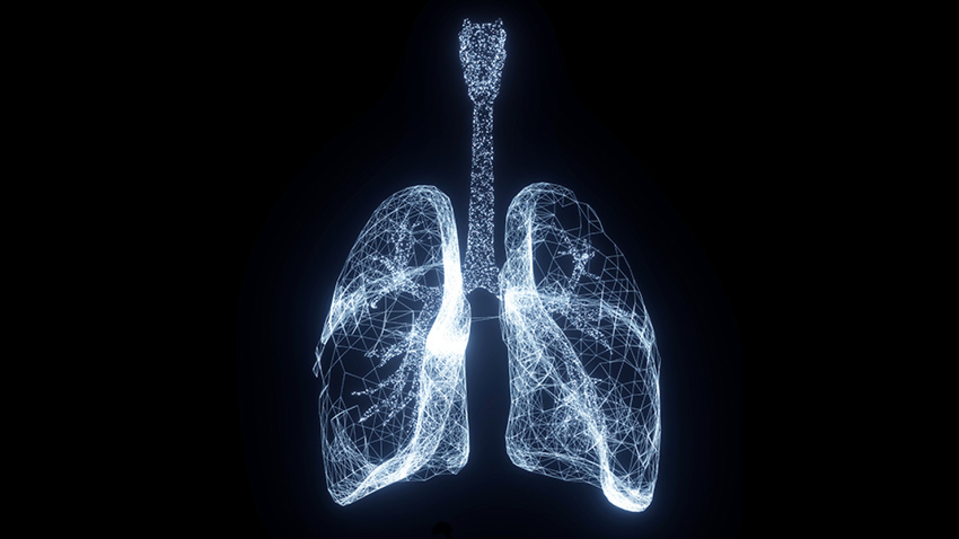 Deep Learning Algorithm Detects Acute Respiratory Distress Syndrome ...