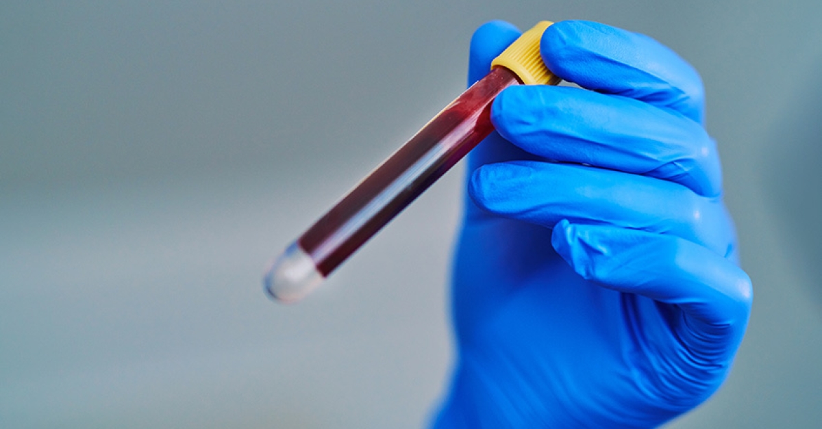 Blood test shows promise for predicting treatment response in ...