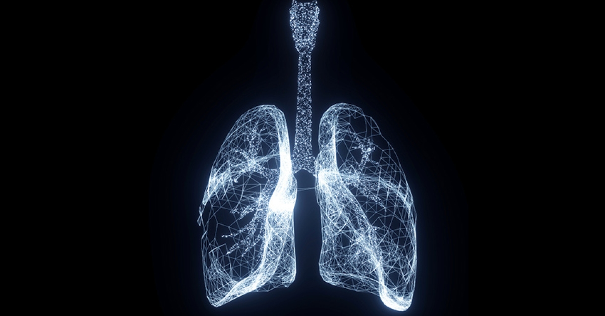 Deep Learning Algorithm Detects Acute Respiratory Distress Syndrome ...