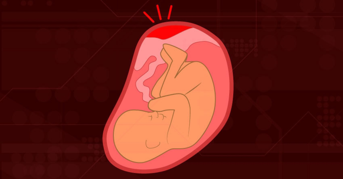 5 Placenta Issues Every Woman Should Know   Placenta Promblems Baby In Womb 