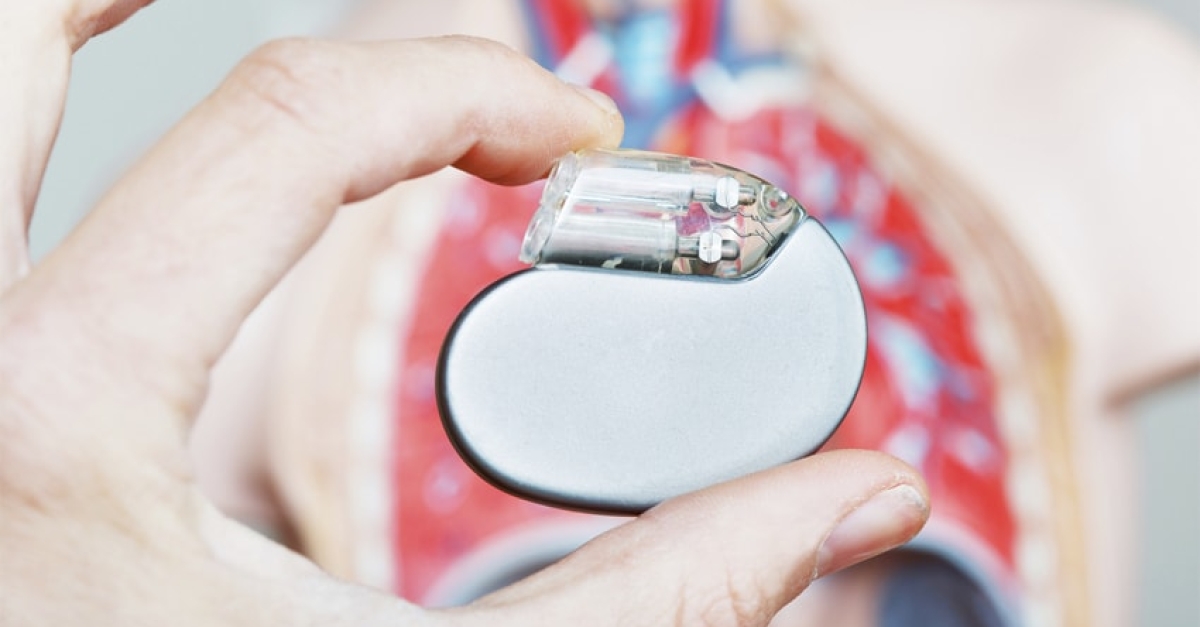 Arrhythmia Treatment and Implantable Cardioverter Defibrillator