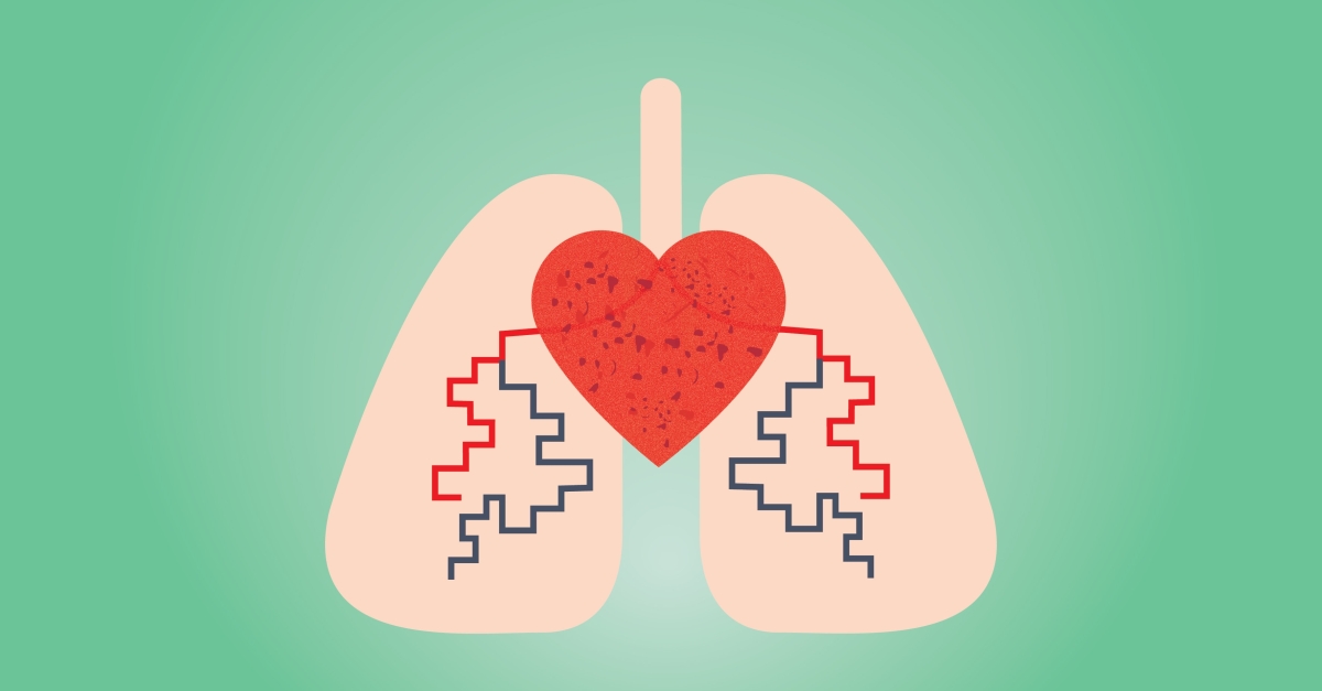 Pulmonary Hypertension Symptoms: PH Treatment, Signs, & Causes