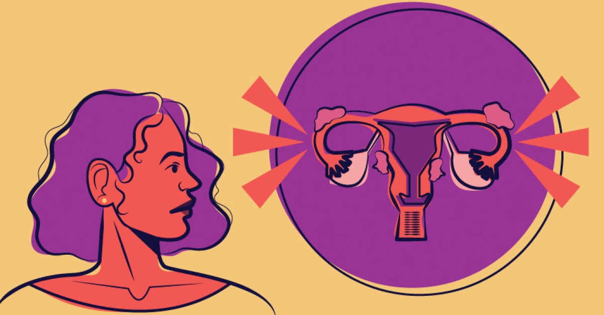 Painful Periods as Predictor of Endometriosis?