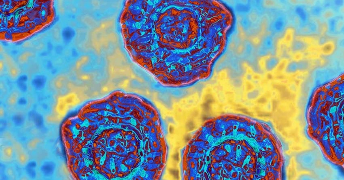 hepatitis c virus microscope