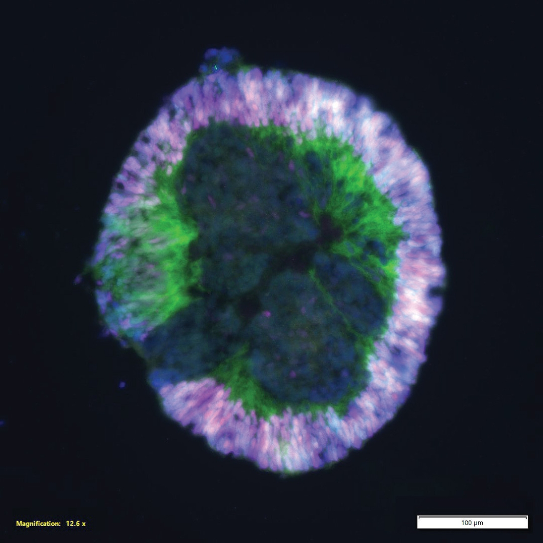 Merged view of retinal development research